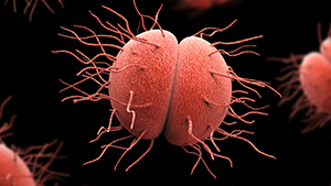 Gonorrea